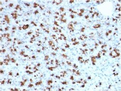 BarX1 Antibody (BARX1/2760) - Azide and BSA Free, Novus Biologicals 100 &mu;g | Buy Online | Novus Biologicals | Fisher Scientific